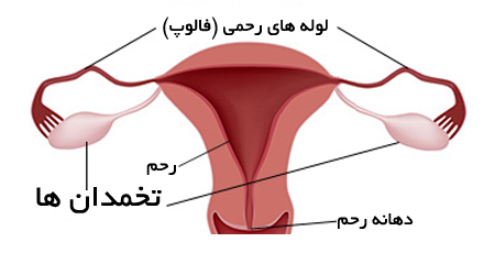 کدام بانوان به کیست دچار می شوند؟