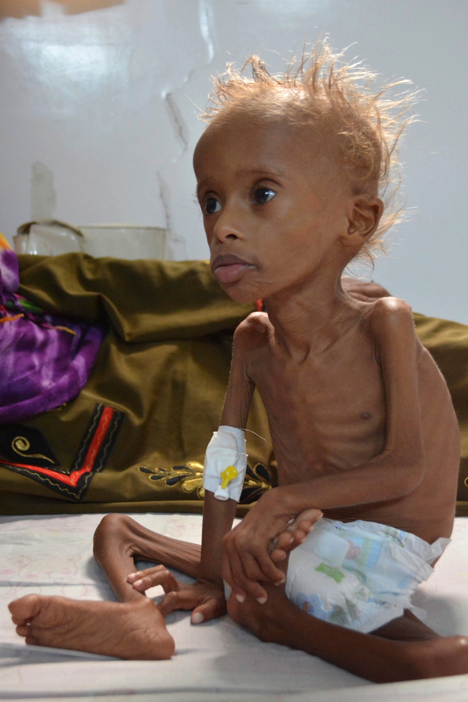گرسنگی ابزار جنگی جدید محمد بن سلمان