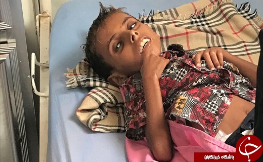 ماجرای غم‌انگیز دختر یمنی تکرار شد