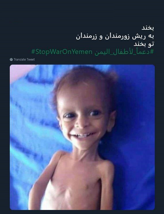 خنده معنادار طفل یمنی