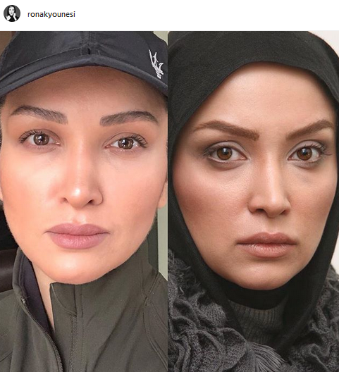چهره ها/ «روناک یونسی» قبل و بعد از مادر شدن
