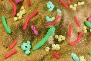 بیماری لوپوس موجب عدم توازن در باکتری‌های روده می‌شود
