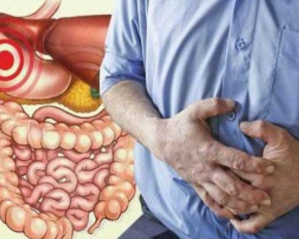 توصیه‌های تغذیه‌ای برای مبتلایان به التهاب روده