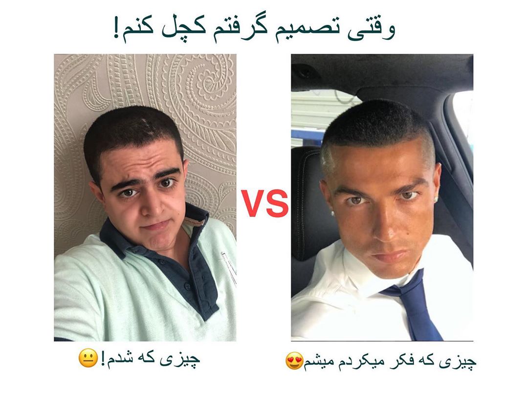 چهره ها/ وقتی امیرمحمد متقیان کچل می کند!
