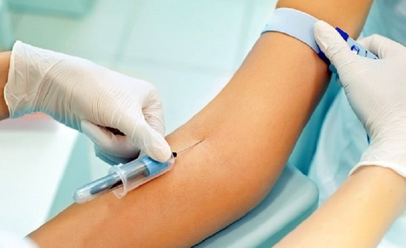  آزمایش خون CRP چیست و چه کاربردی دارد؟