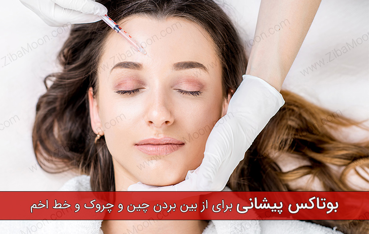 بوتاکس پیشانی برای از بین بردن چین و چروک و خط اخم