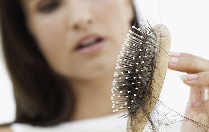 دلایل ریزش موی خانم‌ها