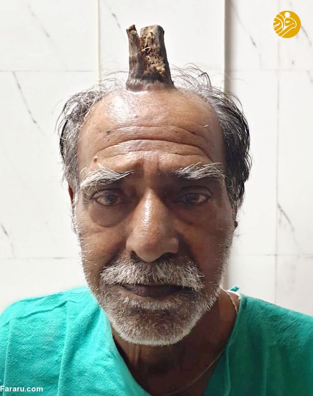 مردی که روی سرش شاخ دارد!