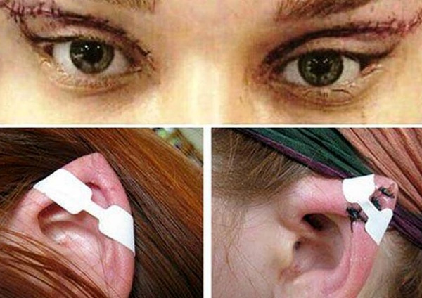 اختلالات روانی و جراحی‌های زیبایی نامتعارف