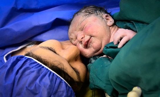 چرا زایمان طبیعی؟!