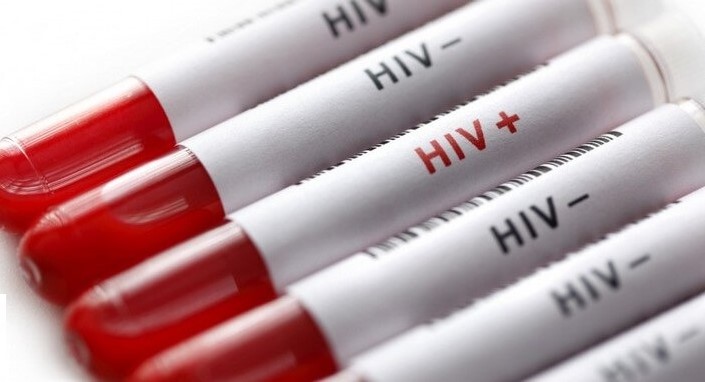 آغوش باز بیمه سلامت برای هزینه آزمایشات ایدز