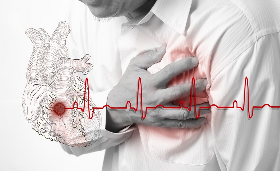 چطور می‌توان از حمله قلبی اول و حملات بعدی آن جلوگیری کرد؟