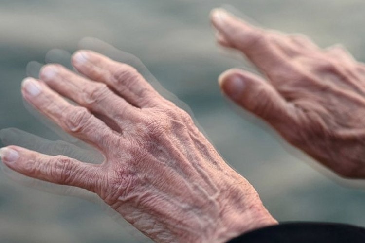 کشف داروی جدید پارکینسون برای مقابله با حرکات غیرارادی