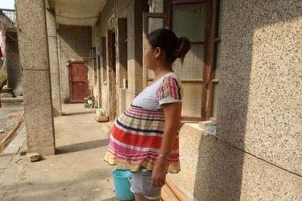 بارداری‌های عجیب و غریب