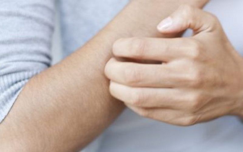کدام علائم پوستی نشانه ابتلا به کروناست؟