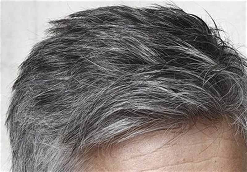امکان بازگشت رنگ طبیعی مو وجود دارد؟