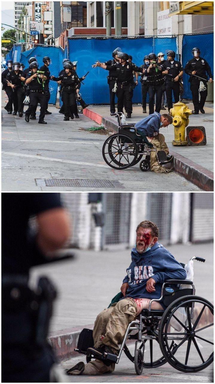 عکس/ معلول بی‌خانمان هدف پلیس لس آنجلس!