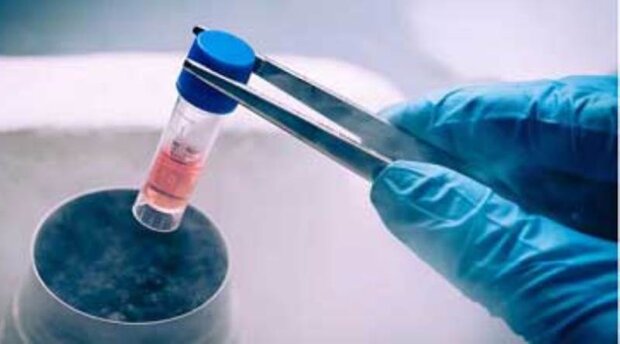 بررسی سلول‌های بنیادی مزانشیمی مغز و تاثیر آن در کیست کلیه