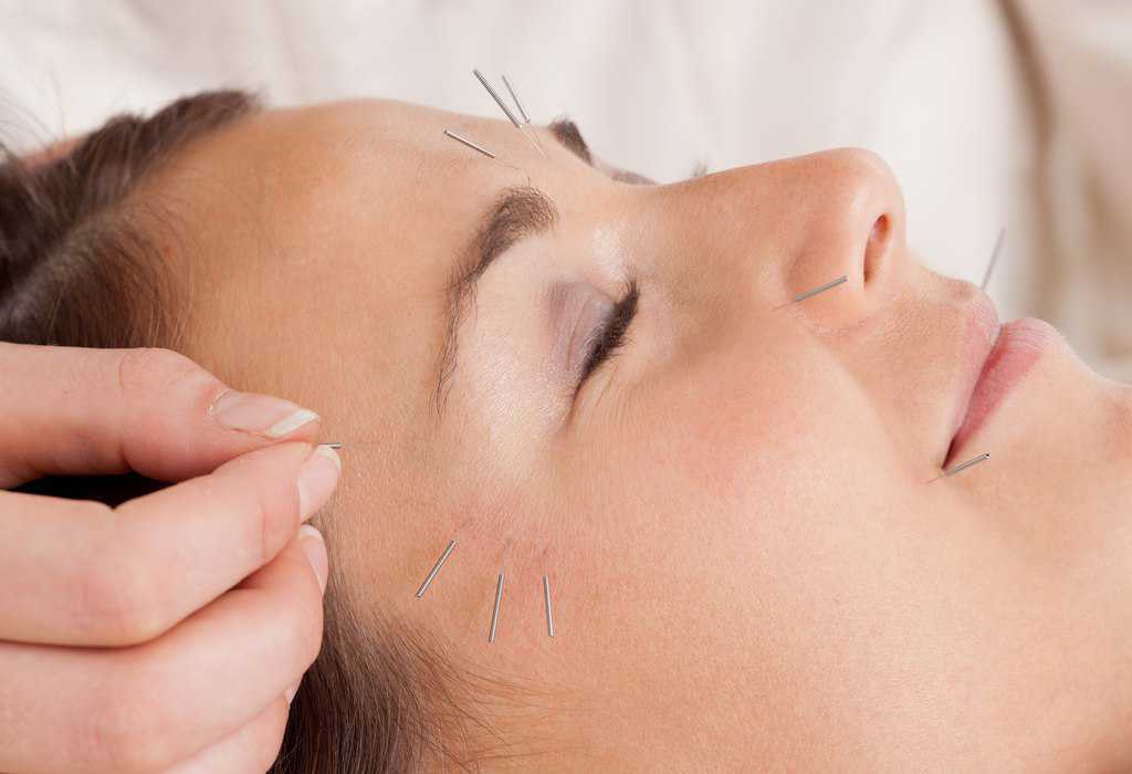 طب سوزنی باعث زیبایی پوست می‌شود؟