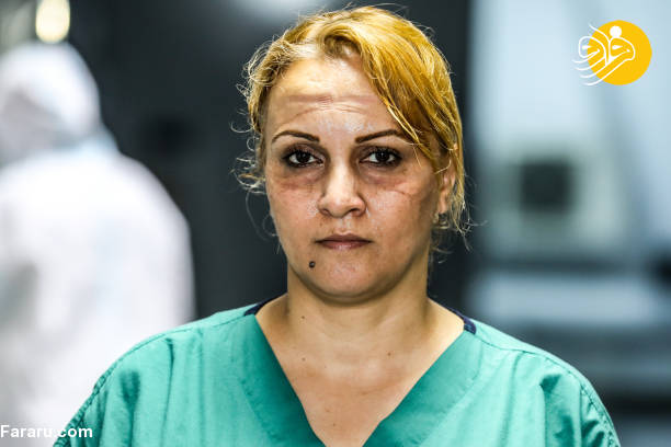 عکس/ اثر ماسک بر چهره پرستاران آذربایجانی