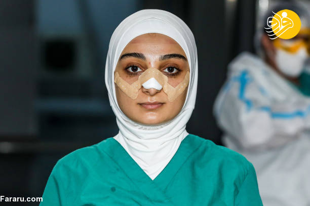 عکس/ اثر ماسک بر چهره پرستاران آذربایجانی