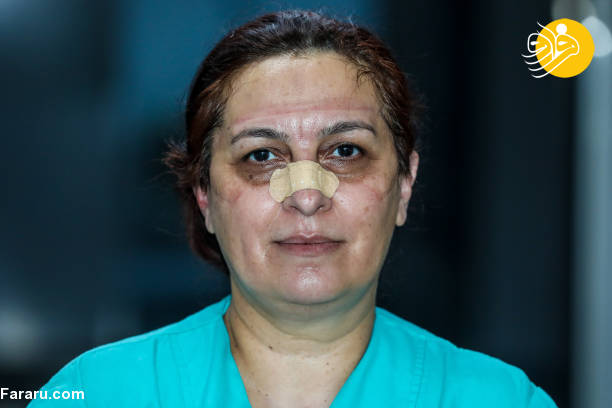عکس/ اثر ماسک بر چهره پرستاران آذربایجانی