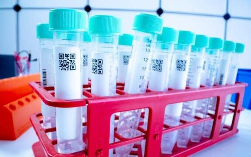 قیمت‌ مجاز تست کرونا در آزمایشگاه‌ها