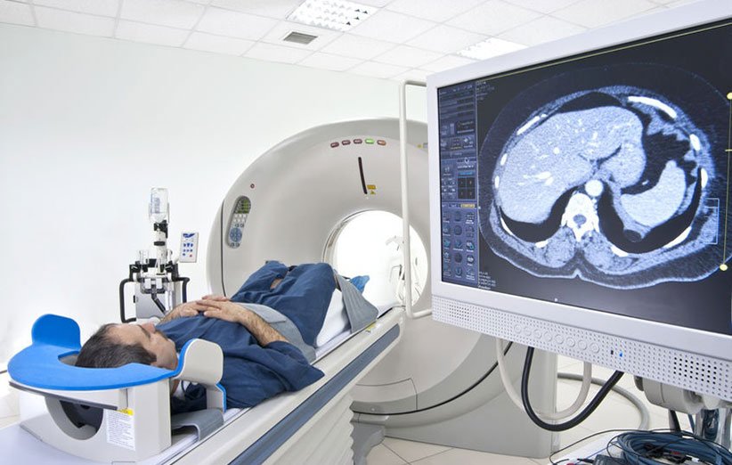 افزایش سرعت عکس‌برداری MRI با استفاده از هوش مصنوعی