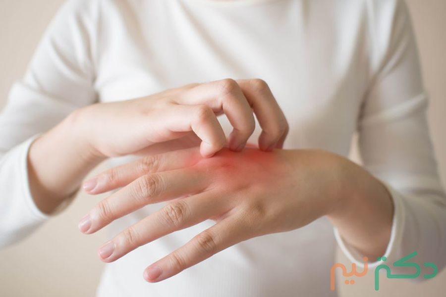 تسکین خارش پوست بدون خاراندن