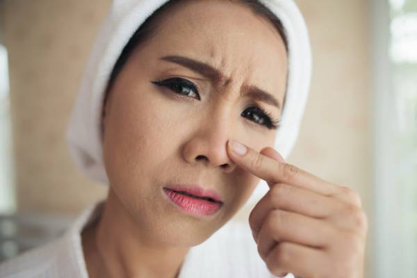 رفع نقطه های سرسیاه بینی در 5 دقیقه