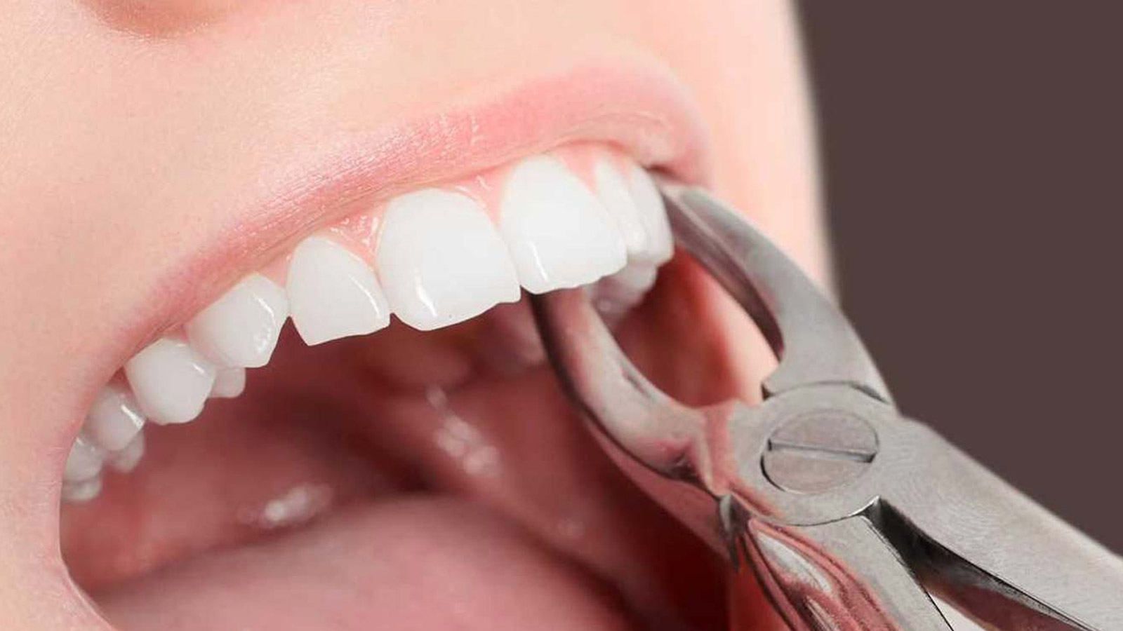 دلایلی که می‌گویند باید دندان‌تان را بکِشید