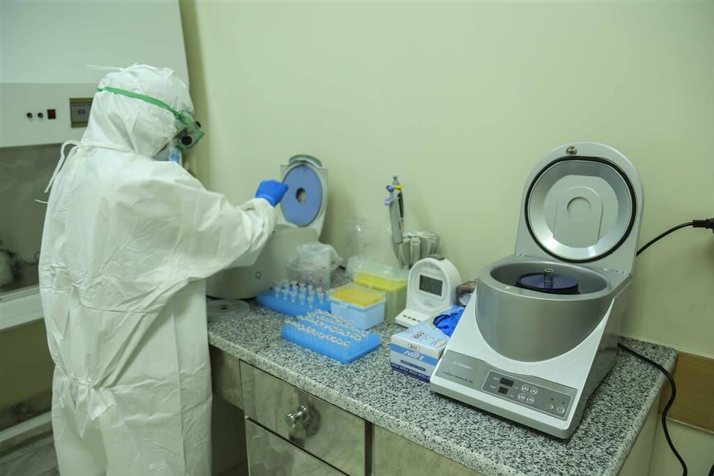 ۱۵۸ مبتلا به کرونا در خراسان جنوبی بهطور سرپایی شناسایی شدند