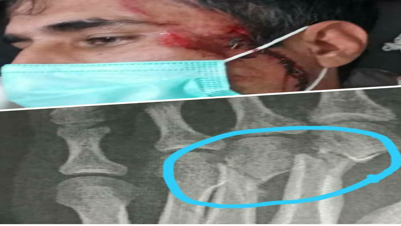 ماموریت رئیس محیط زیست کهنوج حادثه ساز شد