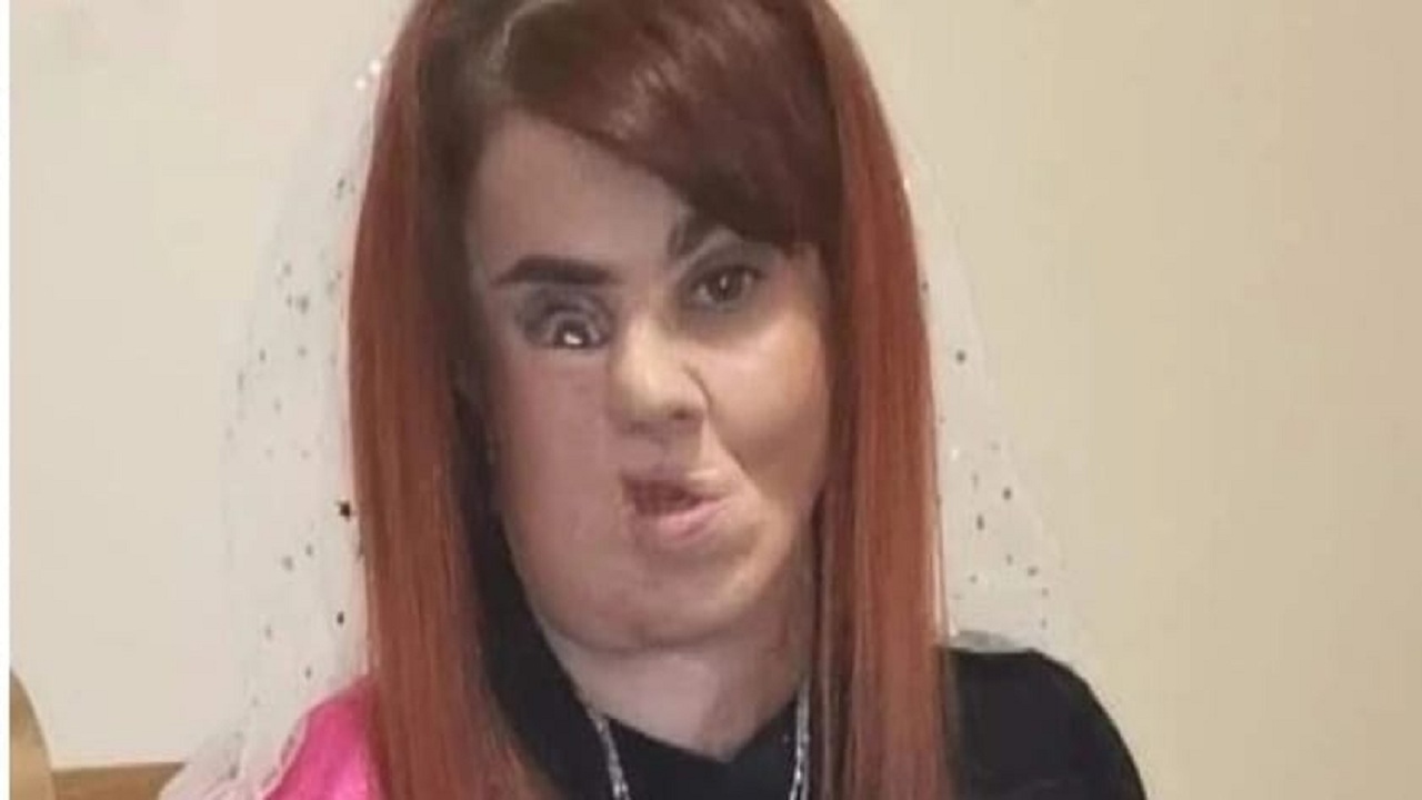 برخورد زننده مهمانان با عروس به خاطر چهره‌اش