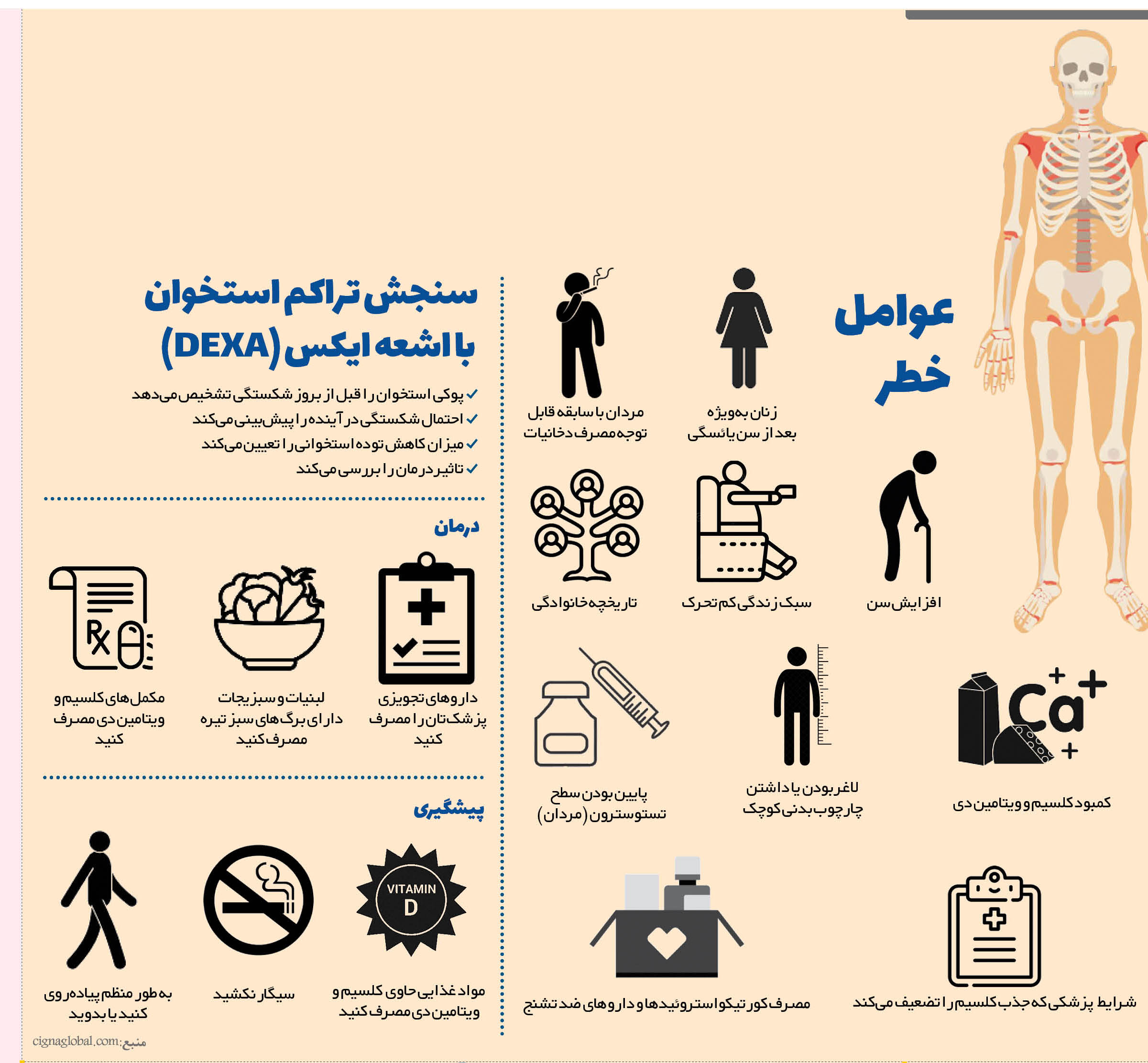 شناخت بیشتر پوکی استخوان