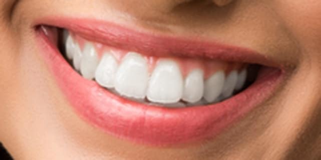 چگونه در فتوشاپ دندانها را سفید و درخشنده کنیم؟