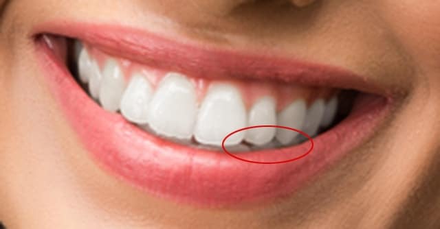چگونه در فتوشاپ دندانها را سفید و درخشنده کنیم؟