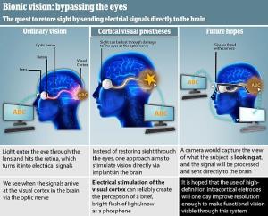 بازیابی بینایی با پیوند الکترود در مغز
