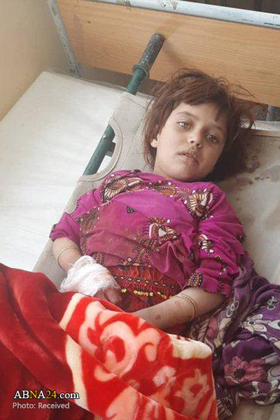 عکس/ کودکان جان باخته بر اثر انفجار در غزنی افغانستان 