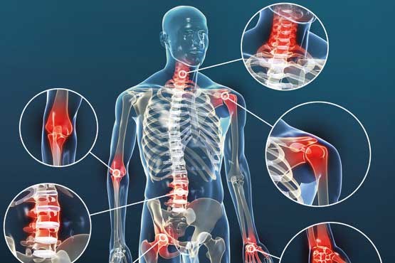 اینفوگرافی/ کدام مفاصل در کرونا بیشتر درگیر می‌شوند؟