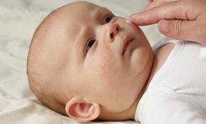 بیماری روزئولا و علائم آن در کودکان و نوزادان