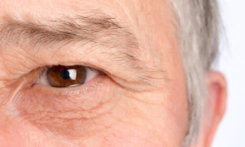 علائم خشکی چشم و روش های درمان آن