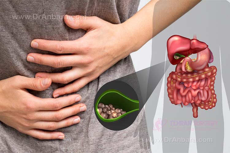 علائم سنگ صفرا چیست؟