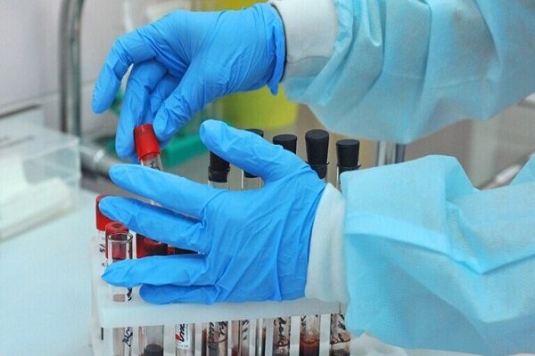 شناسایی ۲۵۸ مورد جدید ابتلا به کرونا در مرکزی