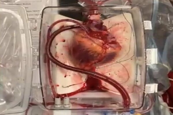 محققان کشور برای سلول‌های تپنده قلب بستر زیست مهندسی شده ساختند