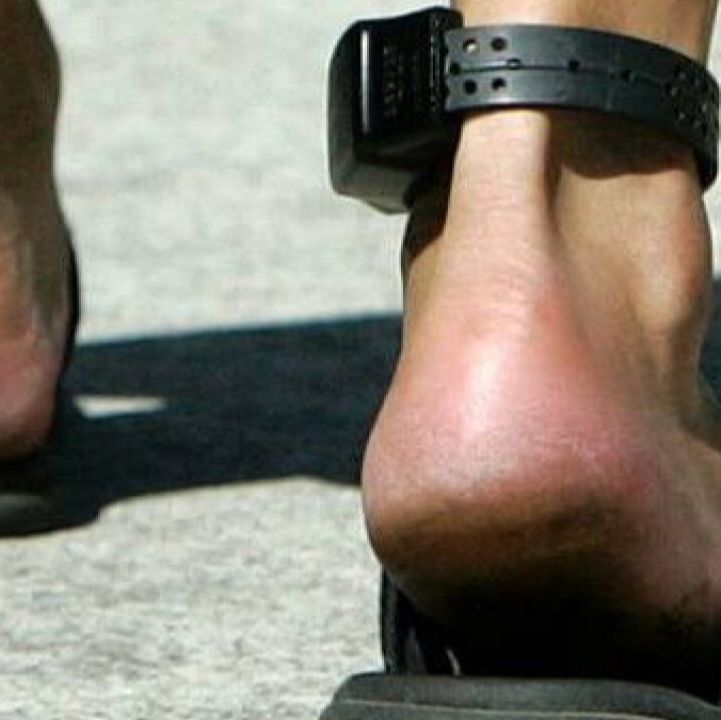 «زندان الکترونیک» و پابندهایی به رنگ رهایی؛ وقتی حبس غیابی میشود