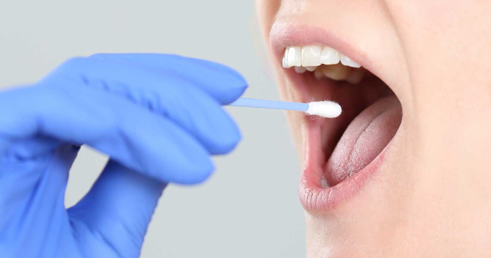 زبانتان دچار چه مشکلاتی میتواند بشود؟ مشکلات زبان؛ علل، تشخیص و درمان