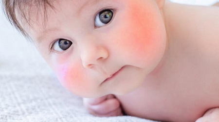 علت گل انداختن و سرخ شدن گونه ها چیست؟