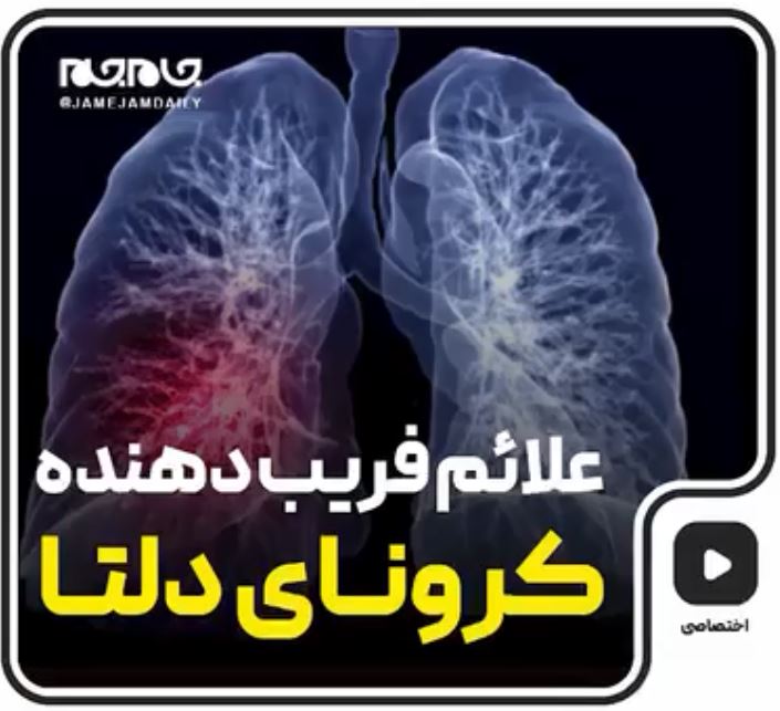 کرونا/ علائم فریب‎ دهنده کرونای دلتا