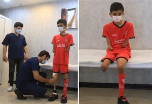 پروتز پای مصنوعی به یک نوجوانان رودانی اهدا شد